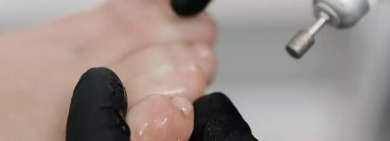 Подологический педикюр - не просто уход, а забота о здоровье